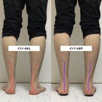 画像1495：施術事例