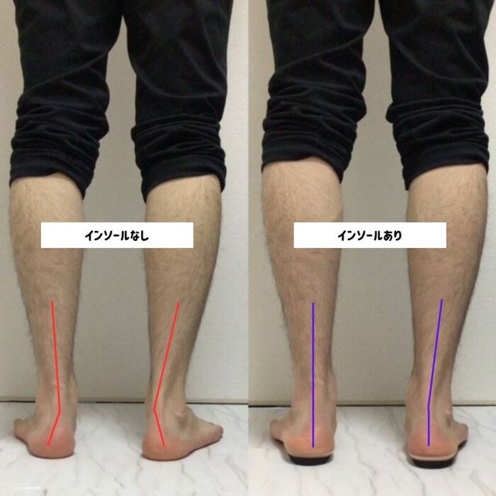 画像1495：施術事例