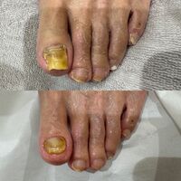 画像15036：施術事例