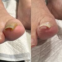 画像15070：施術事例