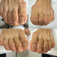 画像4088：施術事例