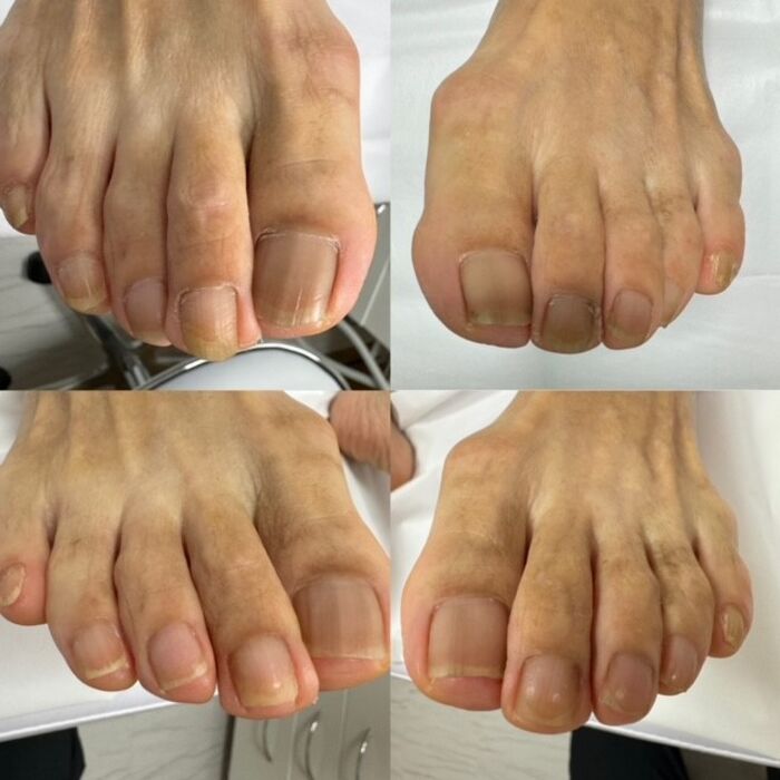 画像4088：施術事例